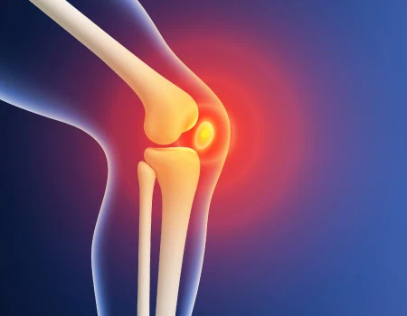 3D image of a knee joint