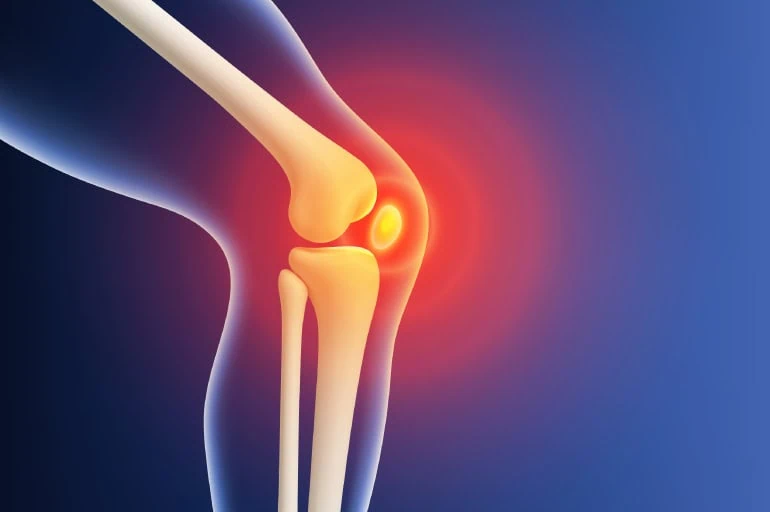 Knee pain illustration